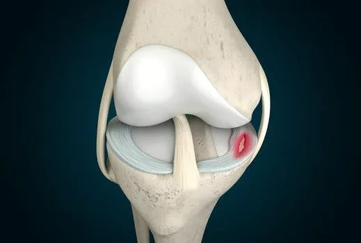 Sụn khớp bị tổn thương: "Lời kêu cứu" của cơ thể