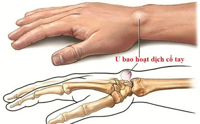 Lắng nghe cơ thể và tìm kiếm sự tư vấn của chuyên gia