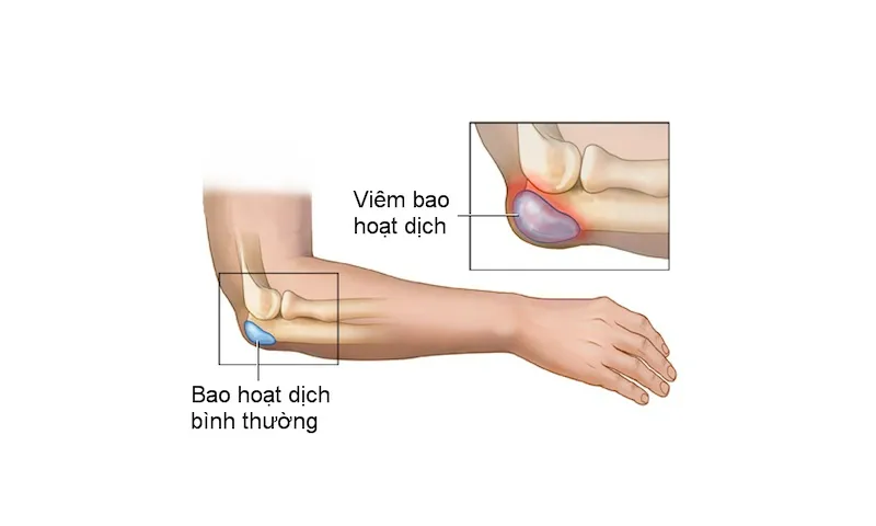 "Sức mạnh" của vật lý trị liệu