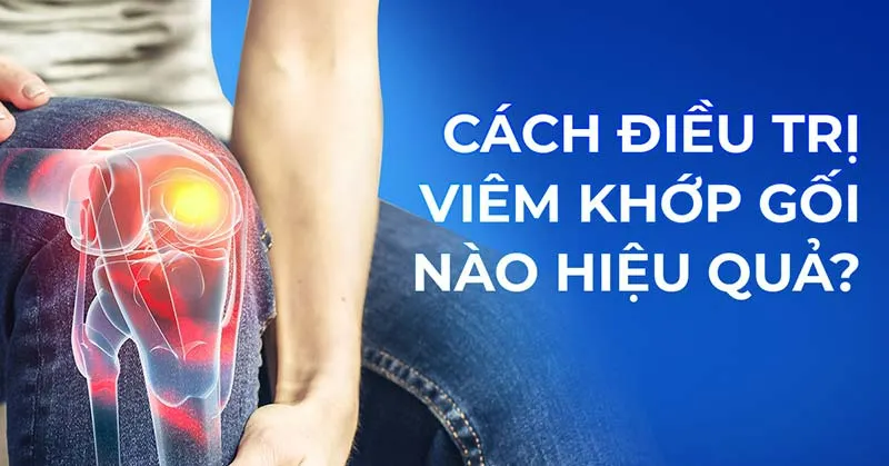 Câu chuyện "khớp gối hồi sinh": Chia sẻ từ người bệnh