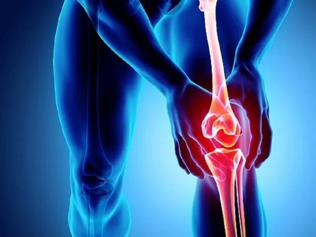 Viêm khớp gối là gì và những "kẻ gây rối" phổ biến