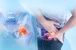 Thoái hóa khớp háng và cách điều trị hiệu quả: Giải pháp từ chuyên gia