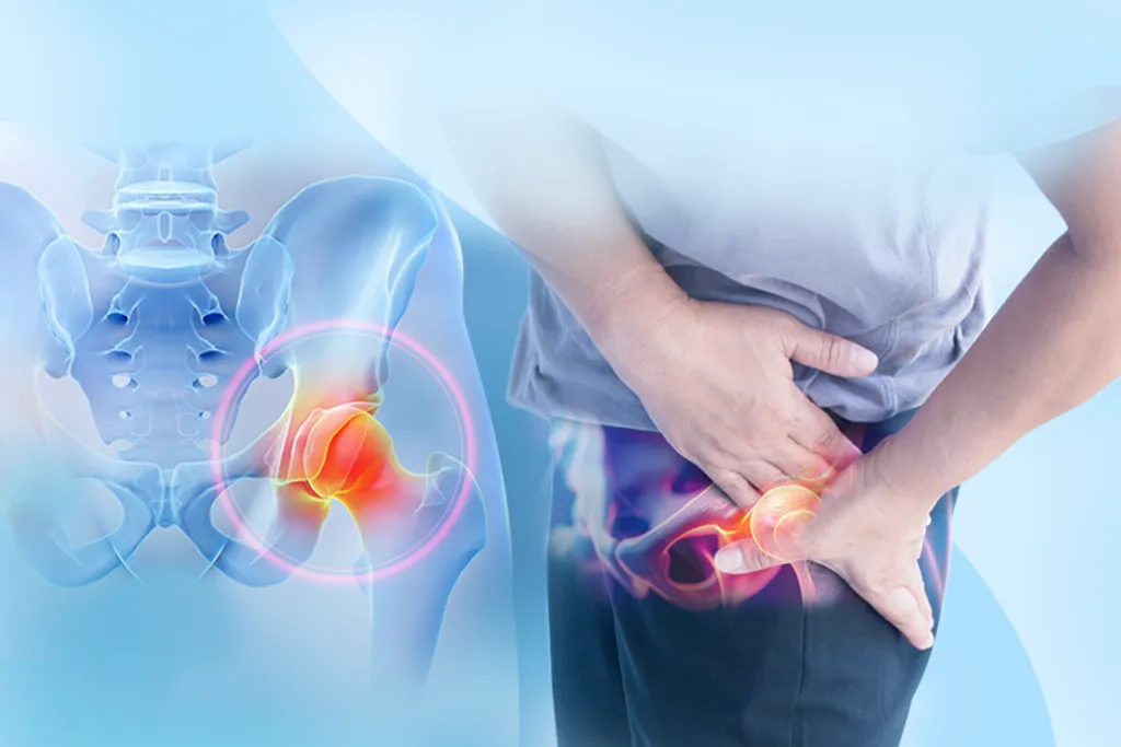 Thoái hóa khớp háng và cách điều trị hiệu quả: Giải pháp từ chuyên gia