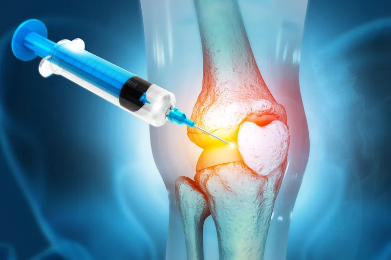 Điều trị sụn khớp bị tổn thương: Từ phương pháp bảo tồn đến can thiệp hiện đại